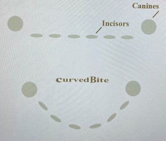 Correct straight bite.